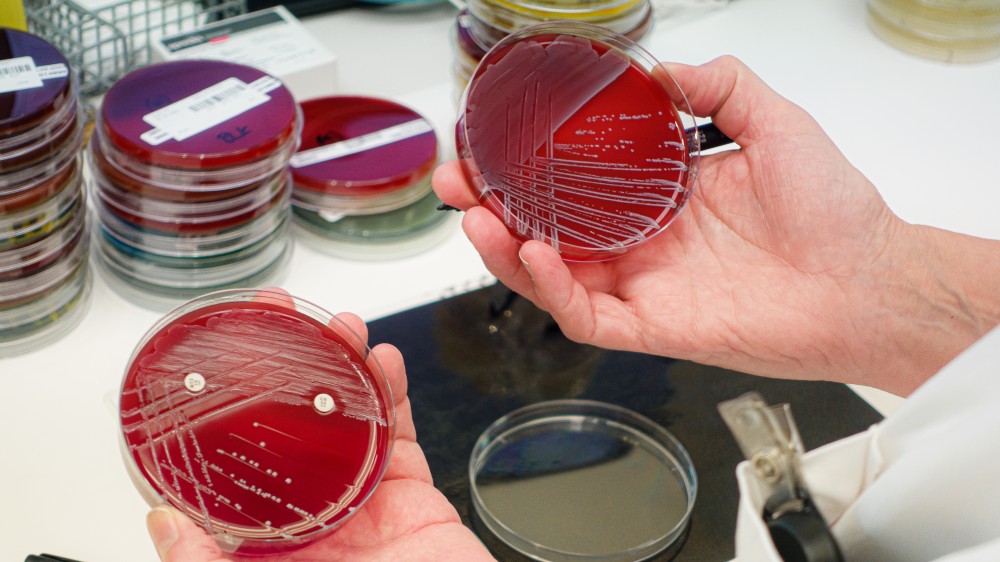 Image shows two hands holding two red agar dishes with white dots and streaks 