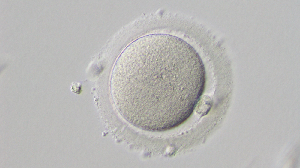 A human egg cell. 