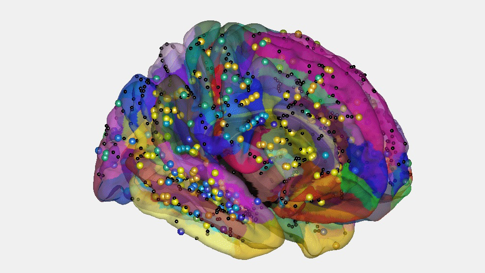 En datagenerert, fargerik modell av menneskehjernen.