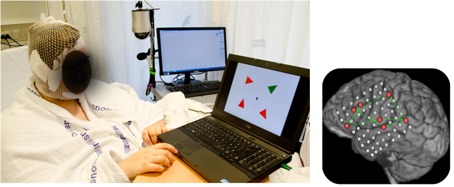 To the left: A man sitting in a hospital bed with a hood on his head that records EEG activity. On a table beside him is two computers. Photo. To the right: Brain imagery. Illustration.
