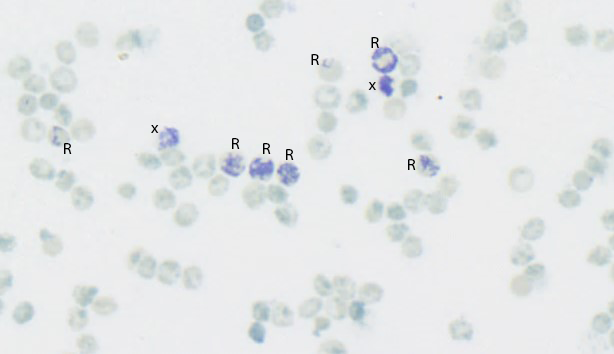 Retikulocytter og erytrocytter