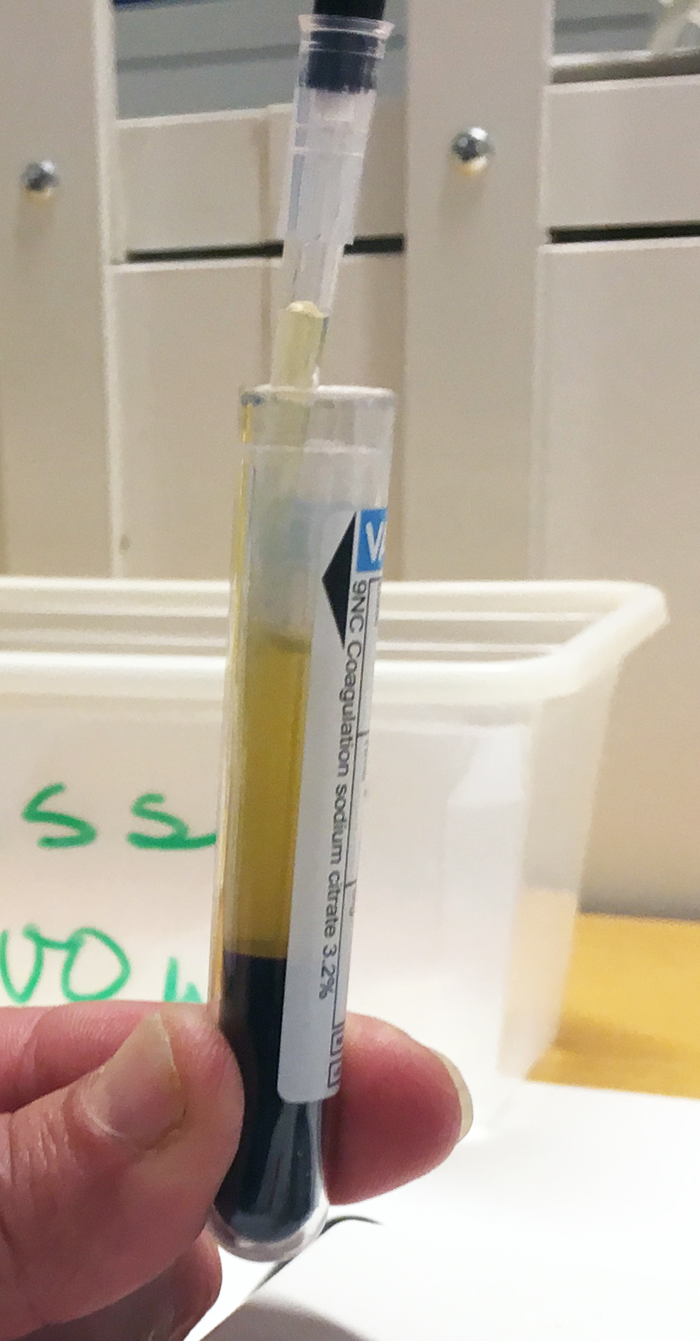 Sentrifugert citratplasma